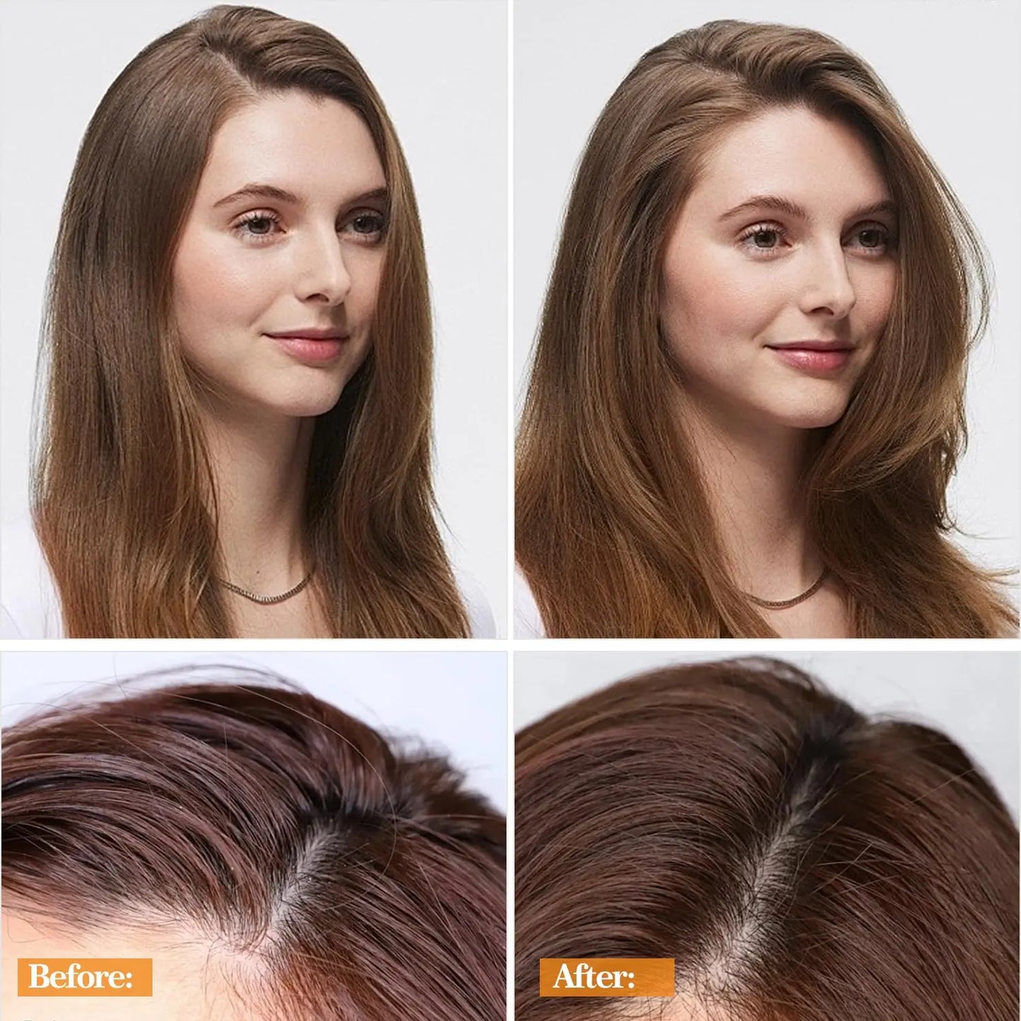 VGO Dry Shampoo Absorbs Oils & Impurities Ultra-Lightweight for All Hair Types, 150ml/ 5.07oz VGObeauty