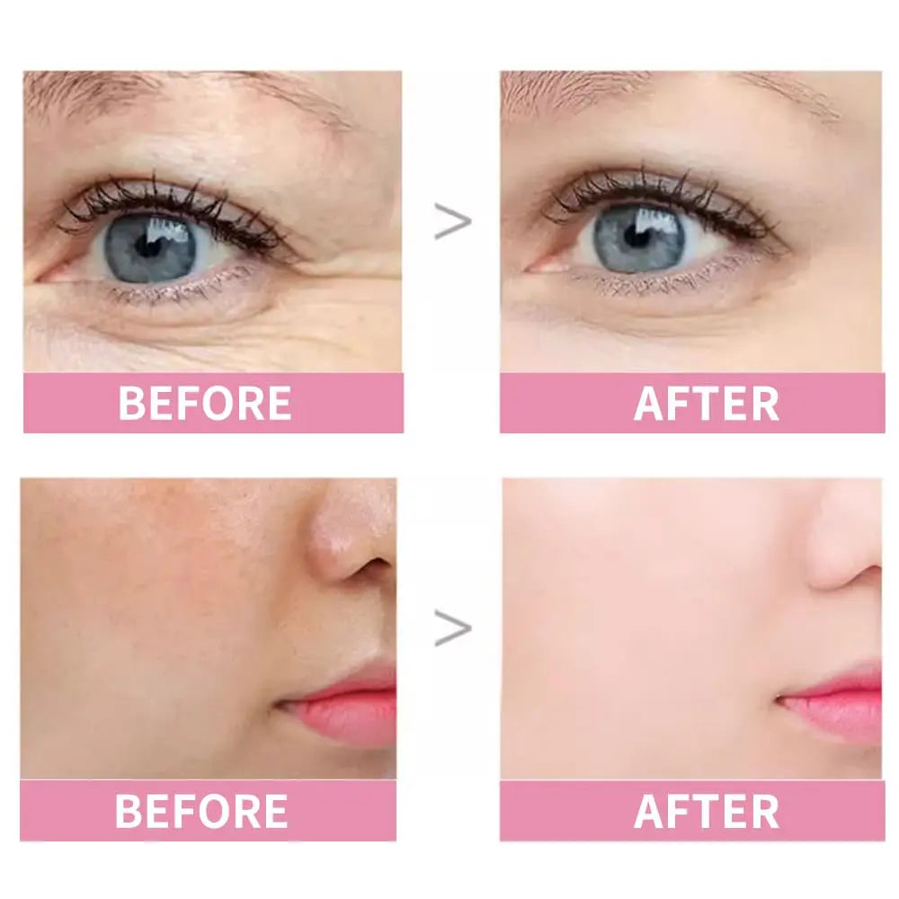 VGO Moisturizing Eye Cream - Anti-wrinkle Moisturizing Eye Cream VGObeauty