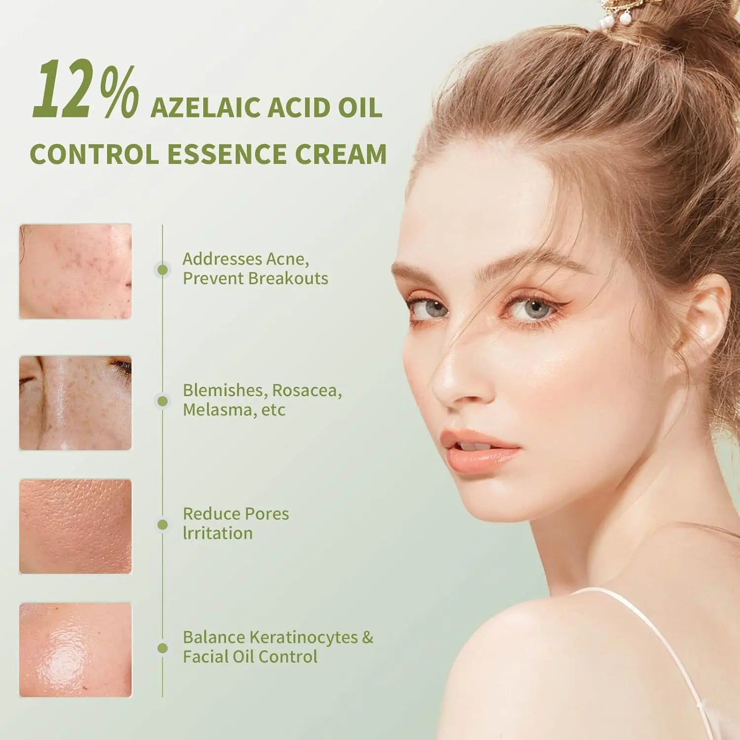 VGO Relief Acne Spot Essence Anti-Acne Serum, 12ml / 0.4oz… VGObeauty