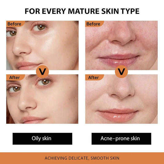 VGO Retinol Face Serum - Anti-Aging & Moisturizing Intense VGObeauty