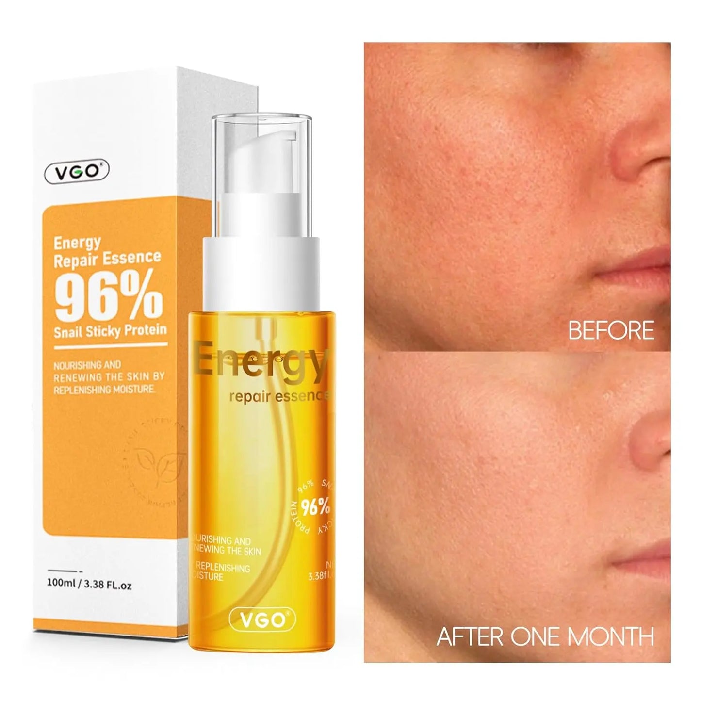 VGO 96% Snail Mucin Serum - Advanced Moisturizing and Anti-Aging Snail Extract Serum VGObeauty