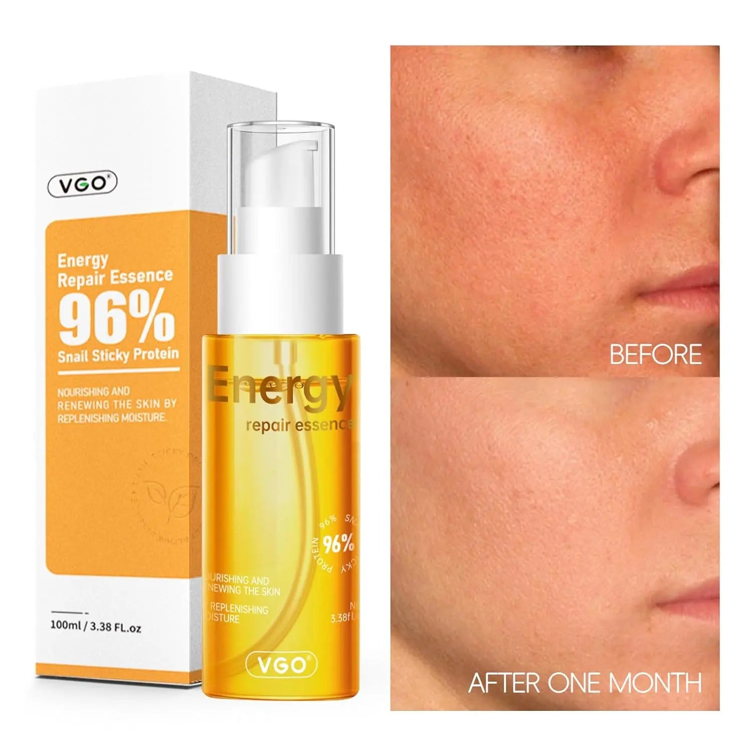 VGO 96% Snail Mucin Serum - Advanced Moisturizing and Anti-Aging Snail Extract Serum VGObeauty
