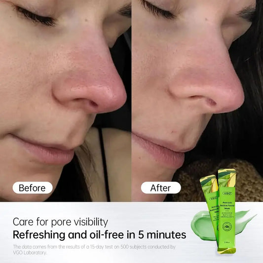 VGO Blackhead Remover Avocado Bubble Mask, Recovery Mud Mask with Salicylic Acid & Hyaluronic Acid, Daily Hydrating Facial Care & Skin Recovery Cream, 12pcs VGObeauty