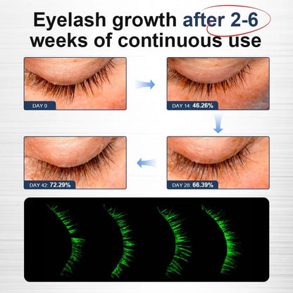 VGO Eyelash Serum - Lash Serum for Eyelash Growth, Clear Effect for Thicker, Longer Lashes with Natural Ingredients - Safe, Gentle & Non-Irritating Eyelash Growth Serum for All Skin Types. VGObeauty