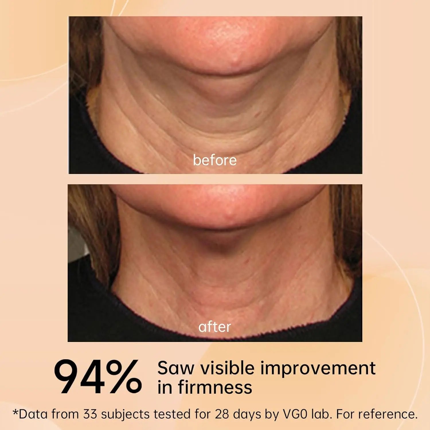 VGO Neck Firming Cream, Reduces Neck Wrinkles VGObeauty