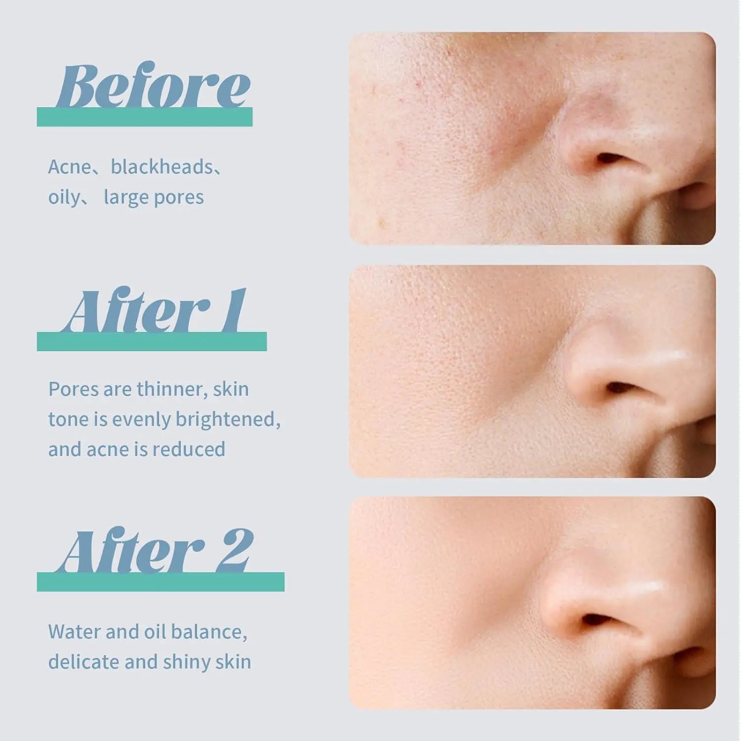 VGO Oil Control Mud Mask 8 Pods Men & Women Facial Mask Skincare Deep Pore Cleansing Blackhead VGObeauty