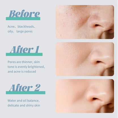 VGO Oil Control Mud Mask 8 Pods Men & Women Facial Mask Skincare Deep Pore Cleansing Blackhead VGObeauty