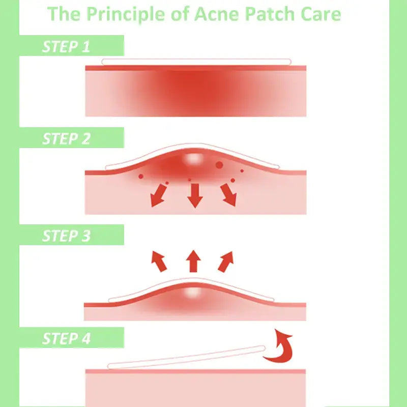 VGO Pimple Patches VGObeauty