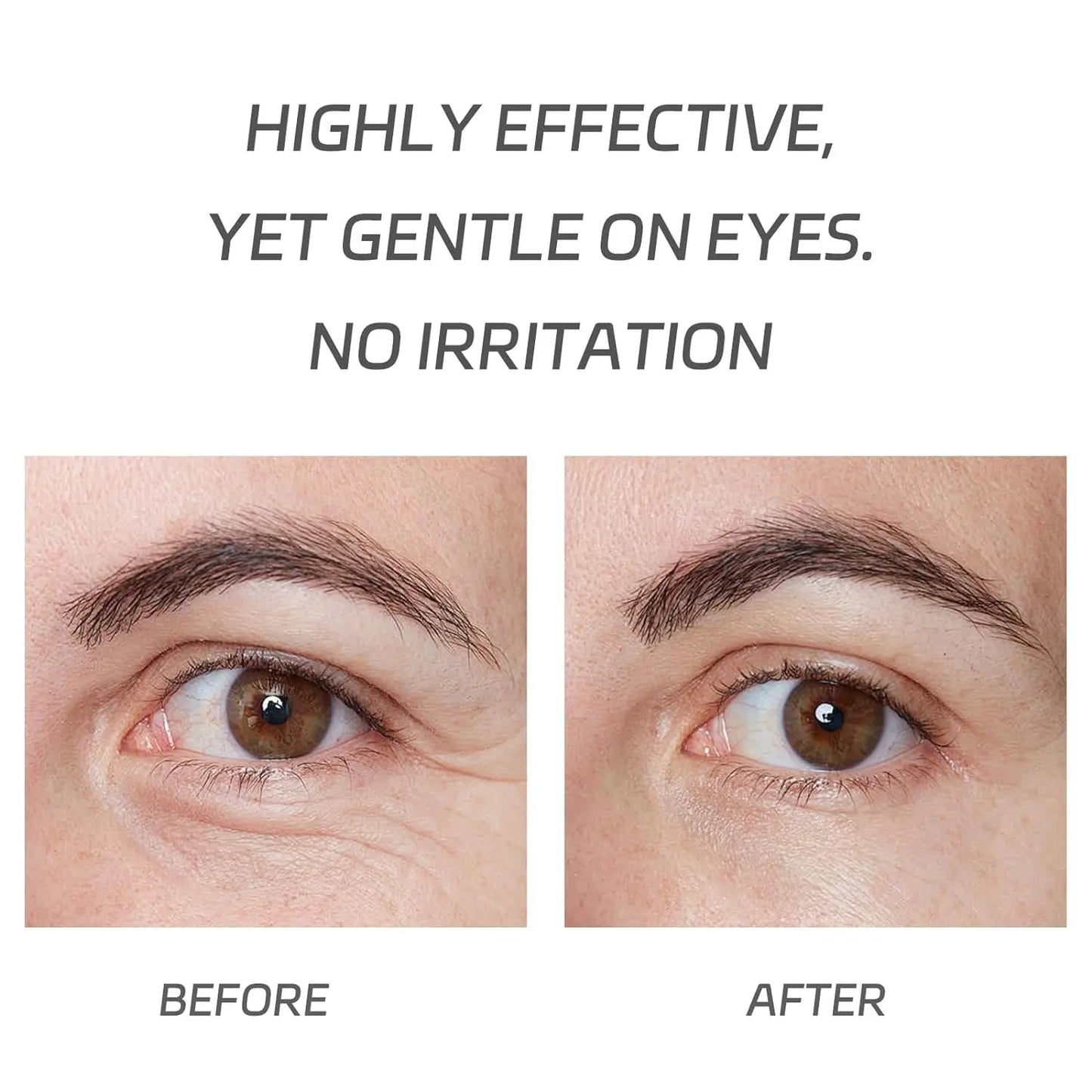 VGO Pro-Xylane Eye Repair Cream, Dark Circles and Puffiness VGObeauty