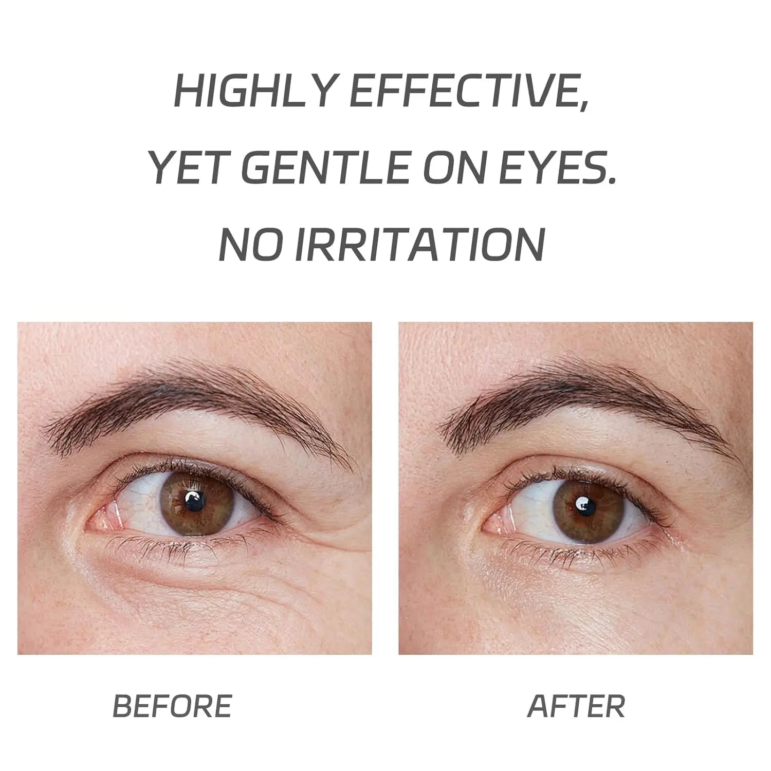 VGO Pro-Xylane Eye Repair Cream, Dark Circles and Puffiness VGObeauty