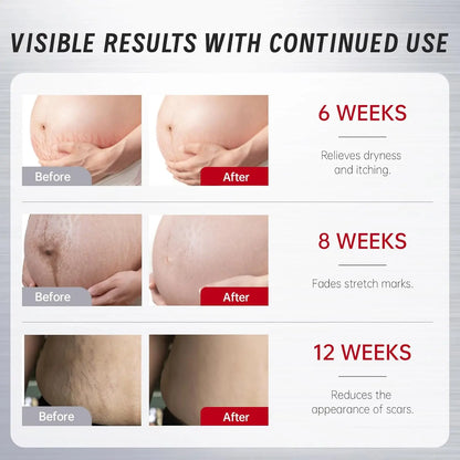 VGO Women's Skin Care Body Oil, Vitamin E Scar Removal Oil VGObeauty