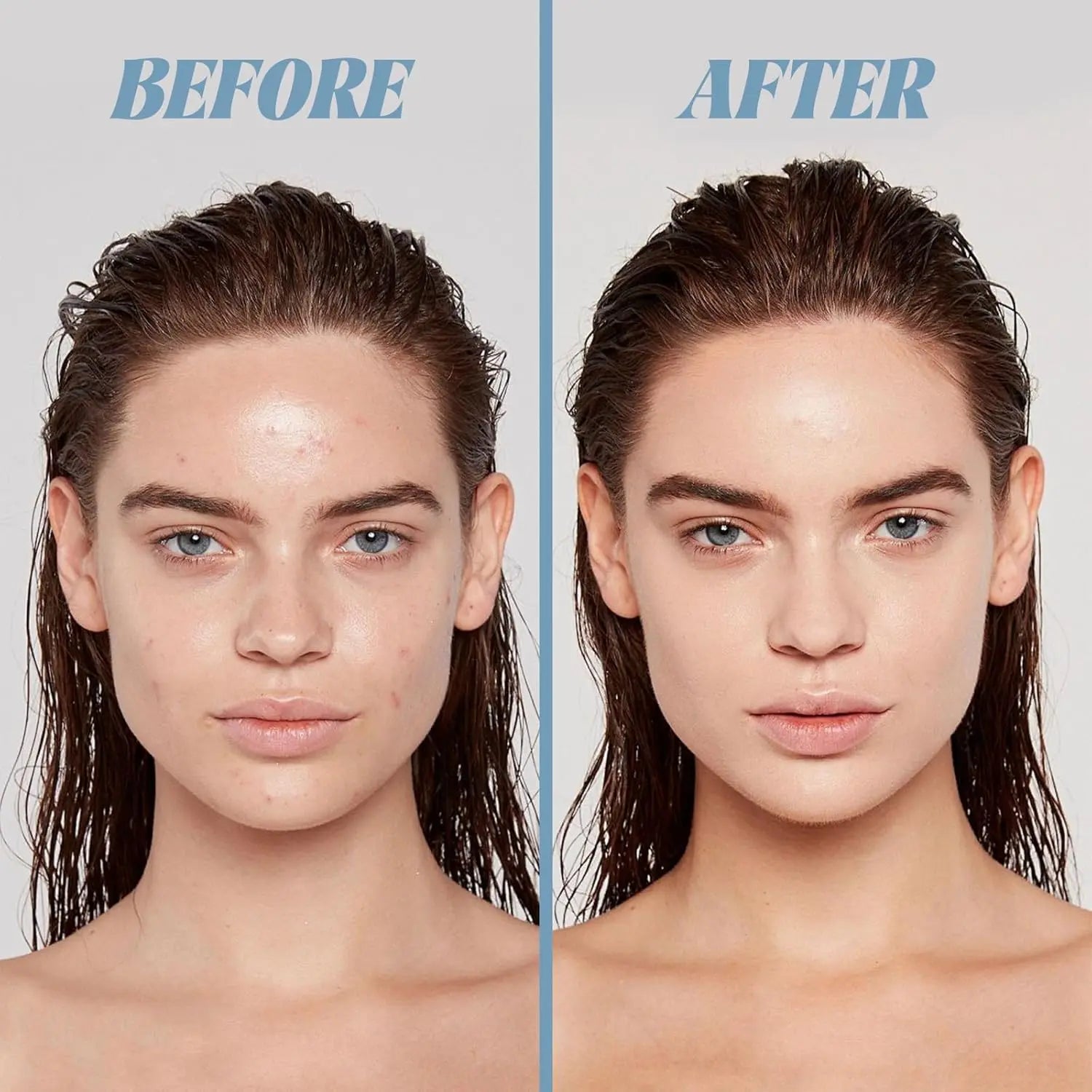 VGO oil control mud mask, deep cleans pores and removes blackheads VGObeauty