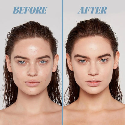 VGO oil control mud mask, deep cleans pores and removes blackheads VGObeauty